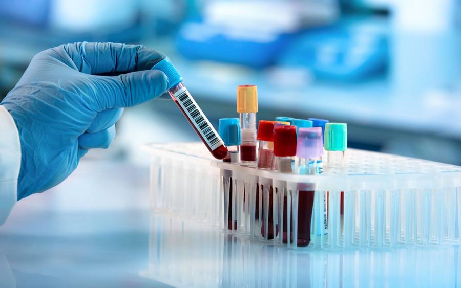 My Blood Test Blueprint: Unlocking Longevity Secrets (And How You Can Too